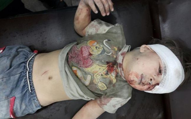زخم‌های کودک مظلوم سوری +تصاویر