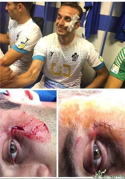 عکس/ مصدومیت شدید بازیکن پیکان