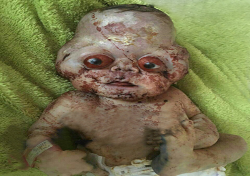 تولد نوزادی عجیب شایعه یا واقعیت؟ +عکس