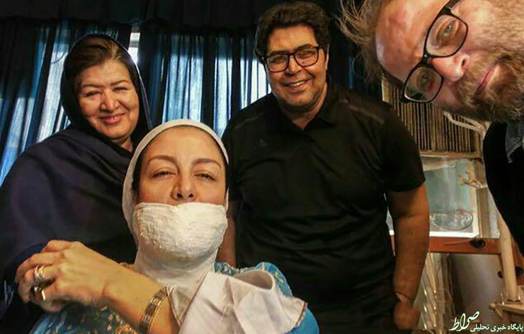 عکس/ صورت گچ گرفته بازیگر زن