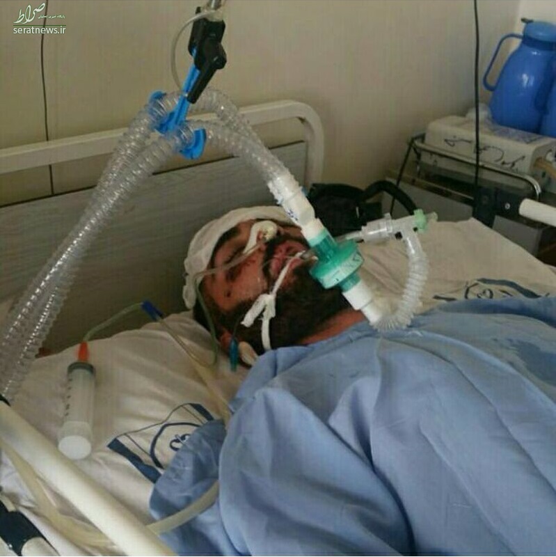 عکس/ رکابزن ملیپوش در کما عکس/ رکابزن ملیپوش در کما