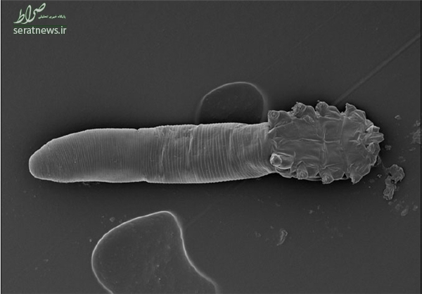کرم‌هایی که روی پوست زندگی می‌کنند+تصاویر
