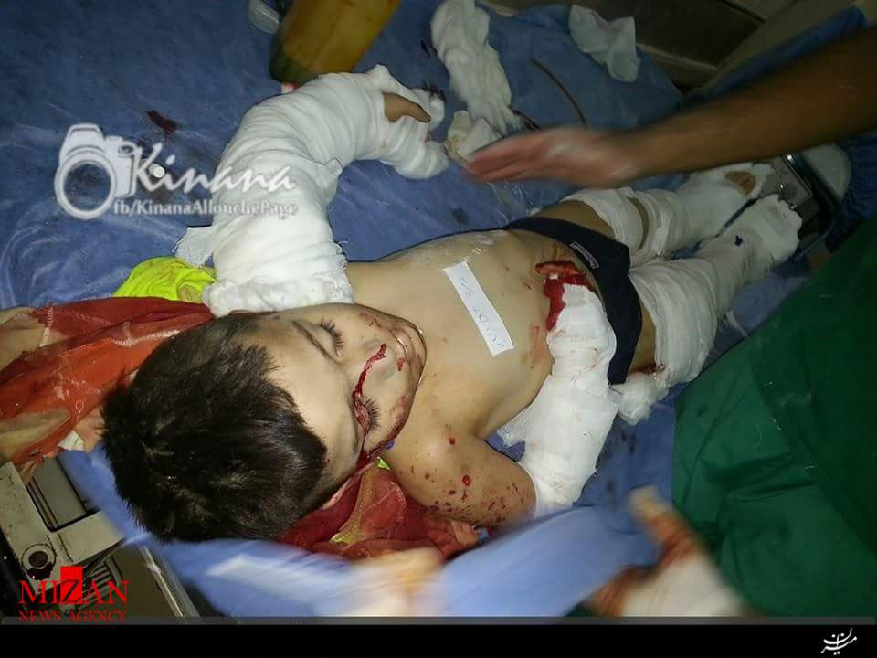 حمله خمپارهای تروریستها به دانشآموزان حلب+تصاویر حمله خمپارهای تروریستها به دانشآموزان حلب+تصاویر