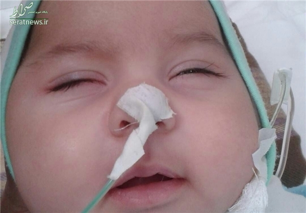 مرگ دلخراش نوزاد در حین درمان +تصاویر