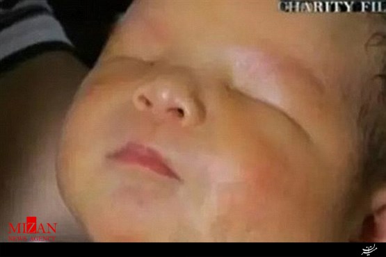 تولد نوزاد بدون چشم در چین+تصاویر تولد نوزاد بدون چشم در چین+تصاویر