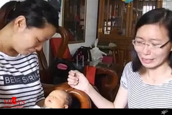 تولد نوزاد بدون چشم در چین+تصاویر
