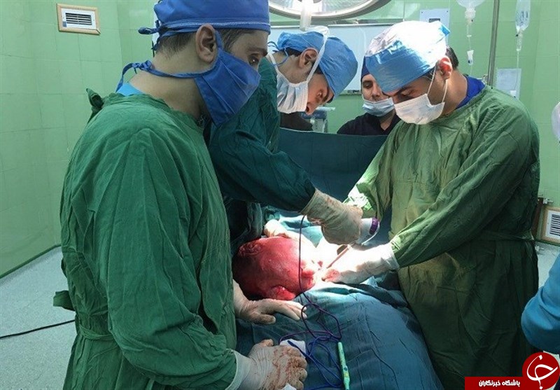برداشتن توده ۷ کیلویی از بدن بیمار گلستانی برداشتن توده ۷ کیلویی از بدن بیمار گلستانی