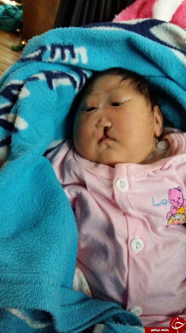 جدال با مرگ کودک 20 ماهه تایلندی +تصاویر جدال با مرگ کودک 20 ماهه تایلندی +تصاویر