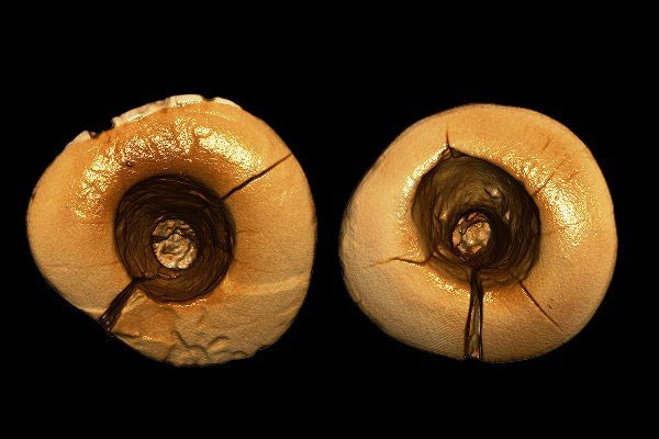 اولین دندان پر شده ۱۳ هزار سال پیش +عکس