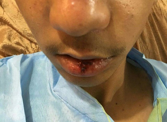 ضربوشتم یک دانشآموز در جیرفت +عکس ضربوشتم یک دانشآموز در جیرفت +عکس