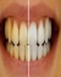 جرم‌گیری دندان با 6 ماده طبیعی