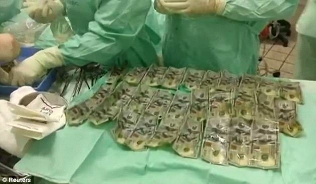 بلعیدن ۷۰۰۰ دلار در پی اختلافات خانوادگی +عکس