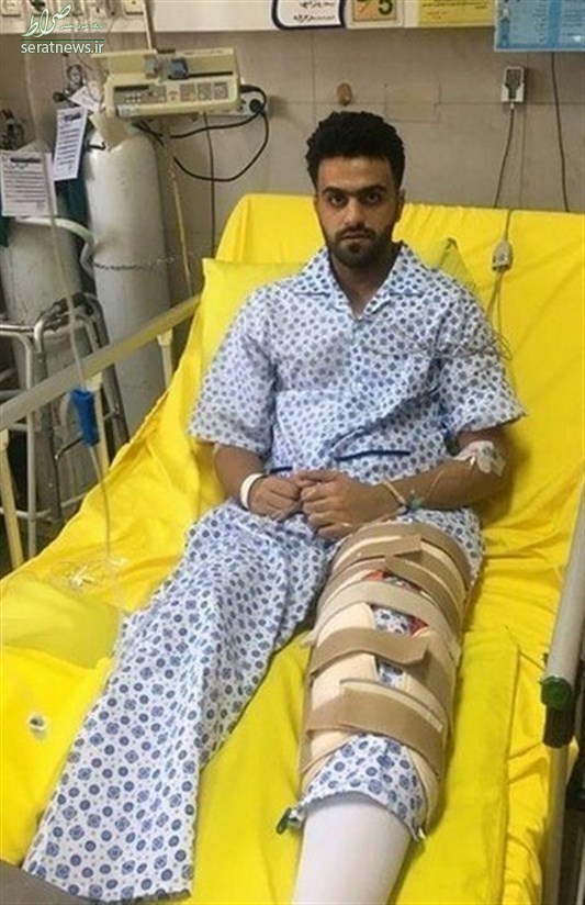 مدافع فولاد خوزستان زیر تیغ جراحی رفت +عکس مدافع فولاد خوزستان زیر تیغ جراحی رفت +عکس