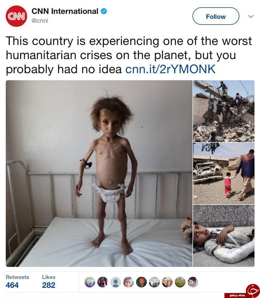 تصاویر وحشتناک توئیتر CNN از یمن +عکس تصاویر وحشتناک توئیتر CNN از یمن +عکس
