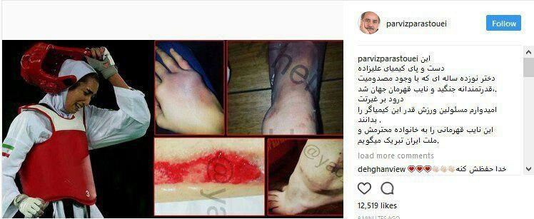 واکنش پرویز پرستویی به نقره کیمیا علیزاده +عکس واکنش پرویز پرستویی به نقره کیمیا علیزاده +عکس