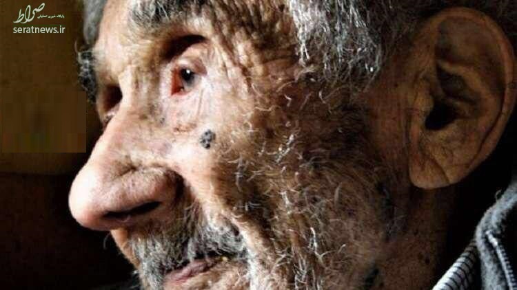 پیرترین انسان جهان در ایران است؟ +عکس
