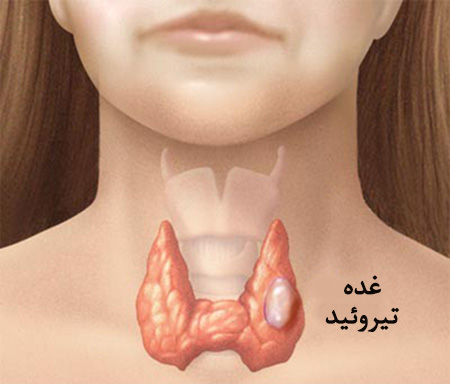 علائم پنهان تیروئید که از آنها بی خبر هستید علائم پنهان تیروئید که از آنها بی خبر هستید