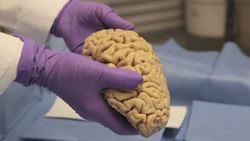 بانک مغز روزنه ای به سوی بیماران سیستم عصبی
