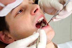 ارتباط بهداشت بد دهان و دندان با خطر ابتلا به دیابت