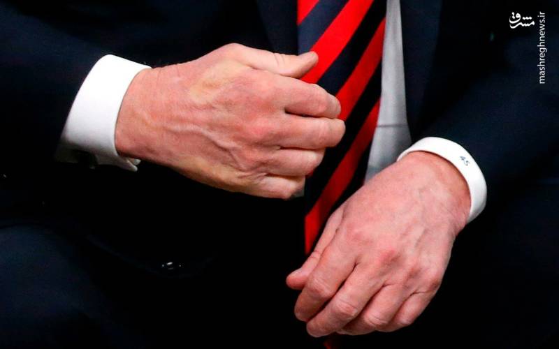 عکس/جای انگشتان مکرون روی دست ترامپ