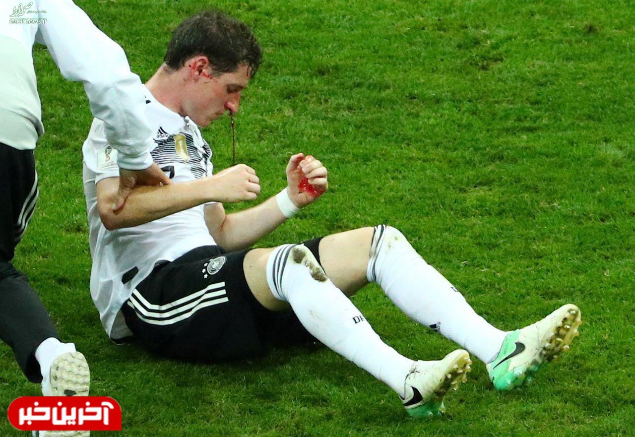 عکس/ لحظه ترس آور شکسته شدن بینی بازیکن آلمان