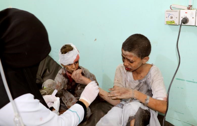 یک پزشک کودکان مصدوم در حملات هوایی شهر صنعا یمن درمان می‌کند