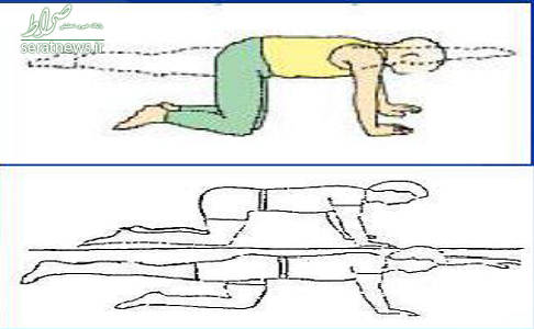 ورزش های مناسب برای درمان گودی کمر +تصاویر