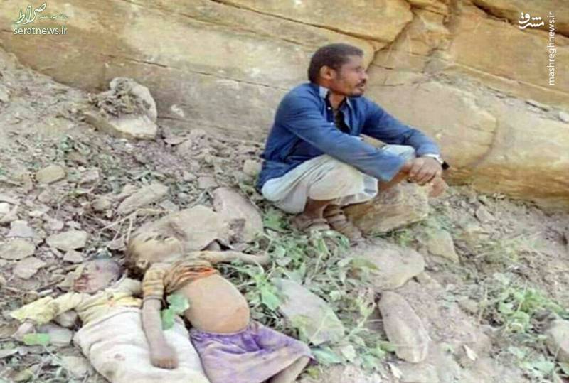 عکس/ تلخ‌ترین تصویر از جنگ یمن(+15)