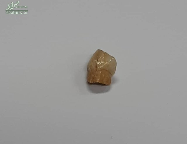 رونمایی از نخستین دندان انسان اولیه ایرانی +عکس