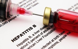 ۱۹۰ هزار مبتلا به هپاتیت C در کشور