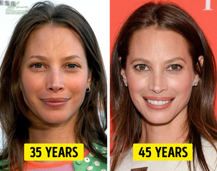بعد از ۳۰ سالگی بدن چه تغییراتی می‌کند؟ +تصاویر