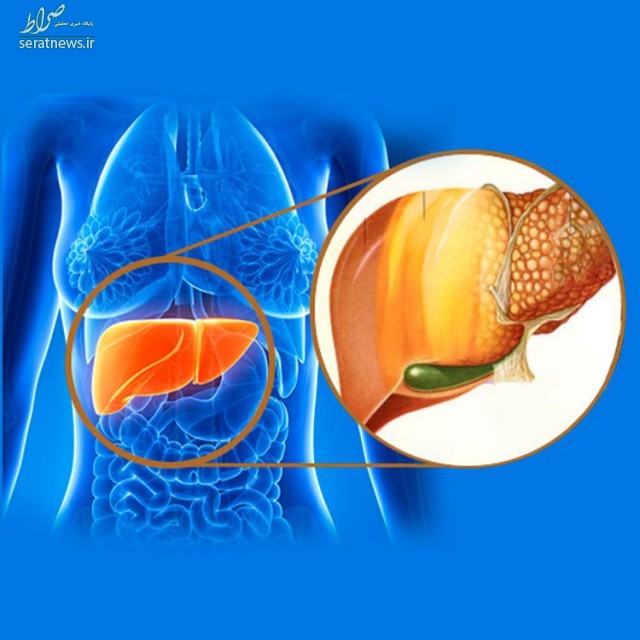 بیماری‌های کبدی چه علائمی دارند؟