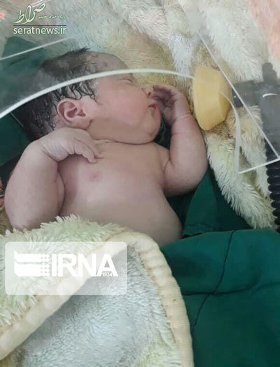 تصاویر/ تولد یک نوزاد از مادر بابلی مبتلا به کرونا