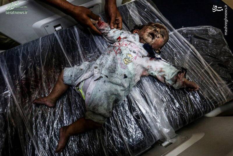 عکس/ شهادت نوزاد فلسطینی ۱۵+