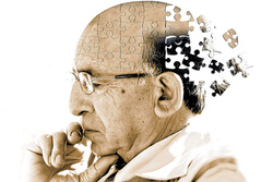 پیش‌بینی آلزایمر سالها قبل از بروز