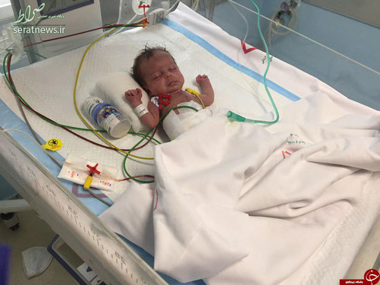 سنگین‌ترین جراحی قلب بر روی نوزاد ١۴٠٠گرمی +تصاویر
