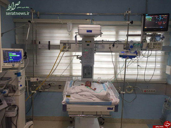 سنگین‌ترین جراحی قلب بر روی نوزاد ١۴٠٠گرمی +تصاویر