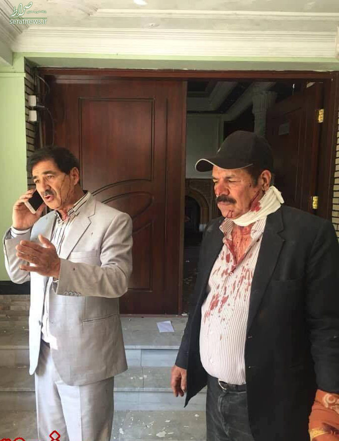 زخمی شدن رئیس فدارسیون‌فوتبال‌افغانستان در انفجار کابل+عکس