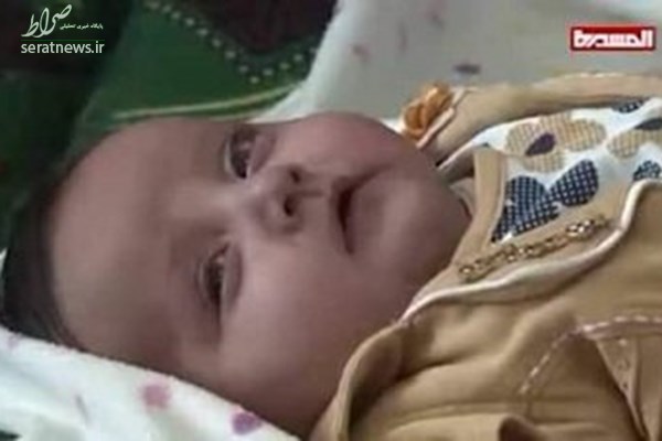 نوزادی که به دلیل محاصره فرودگاه یمن قربانی شد +عکس