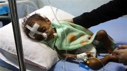 اعتراف سازمان ملل به وضعیت وخیم میلیون‌ها یمنی
