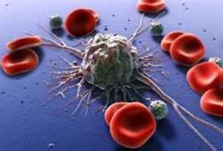 مهار سلول‌های سرطانی با «ویتامین دی»