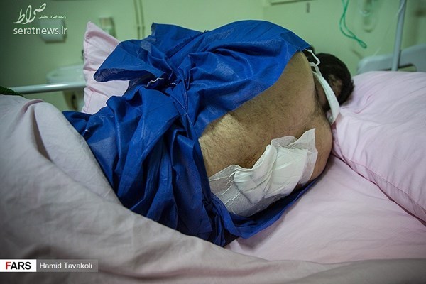 وضعیت وخیم مأموران ناجا که در اعتراضات اخیر مجروح شدند +تصاویر
