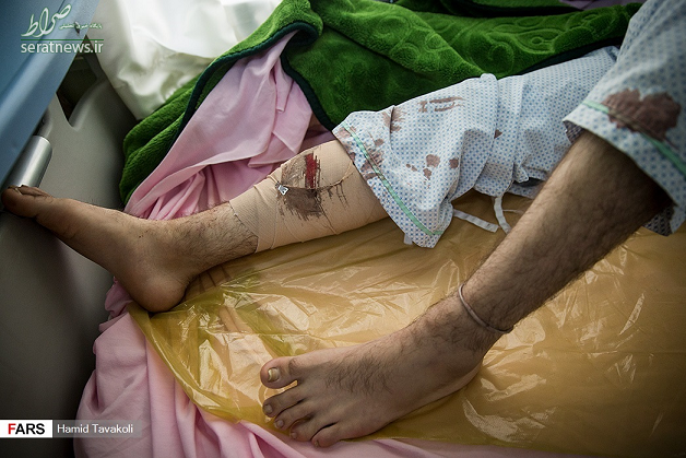 وضعیت وخیم مأموران ناجا که در اعتراضات اخیر مجروح شدند +تصاویر