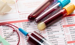 علائم اختصاری آزمایش خون را بشناسید