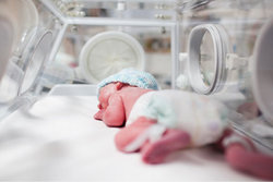 علت تولد نوزاد نارس چیست؟