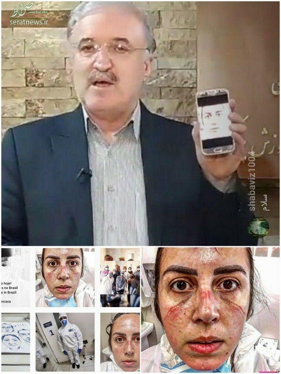 عکس/ چشم و ابروی مشکی، وزیر بهداشت را فریب داد!