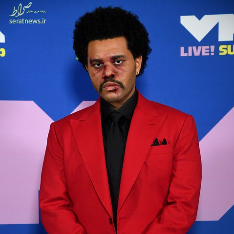 ماجرای صورت باندپیچی خواننده کانادایی+عکس ماجرای صورت باندپیچی خواننده کانادایی+عکس