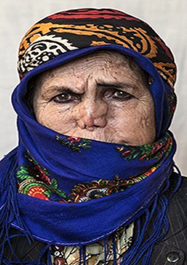 فقط چند دقیقه با جذامیهای ایران