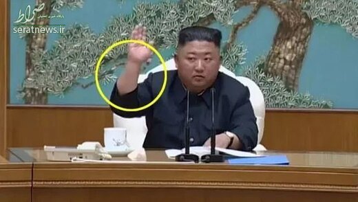 عکس/ راز جای سوزن روی دست رهبر کره شمالی چیست؟