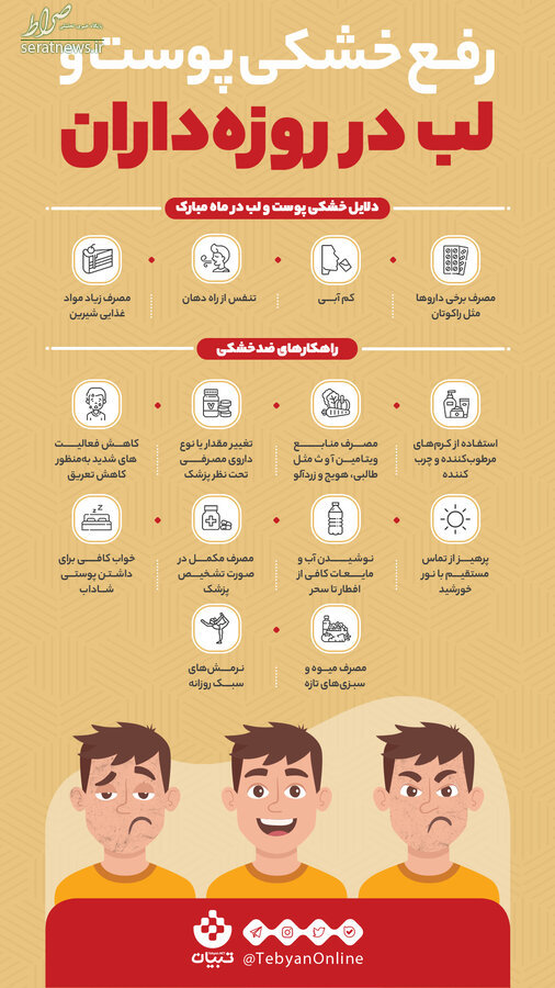 اینفوگرافی/ راهکارهایی برای رفع خشکی پوست و لب روزه‌داران